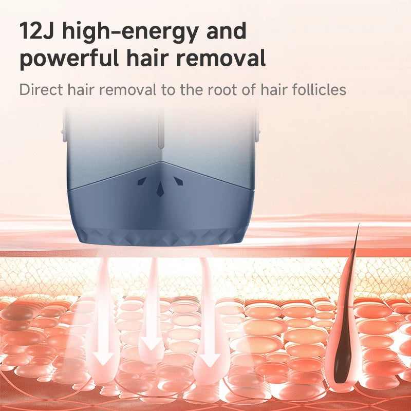 ICE Cooling Hair Removal Device With Unlimited Shots, Permanent IPL Laser, Home Use Painless Epilator For Women Men