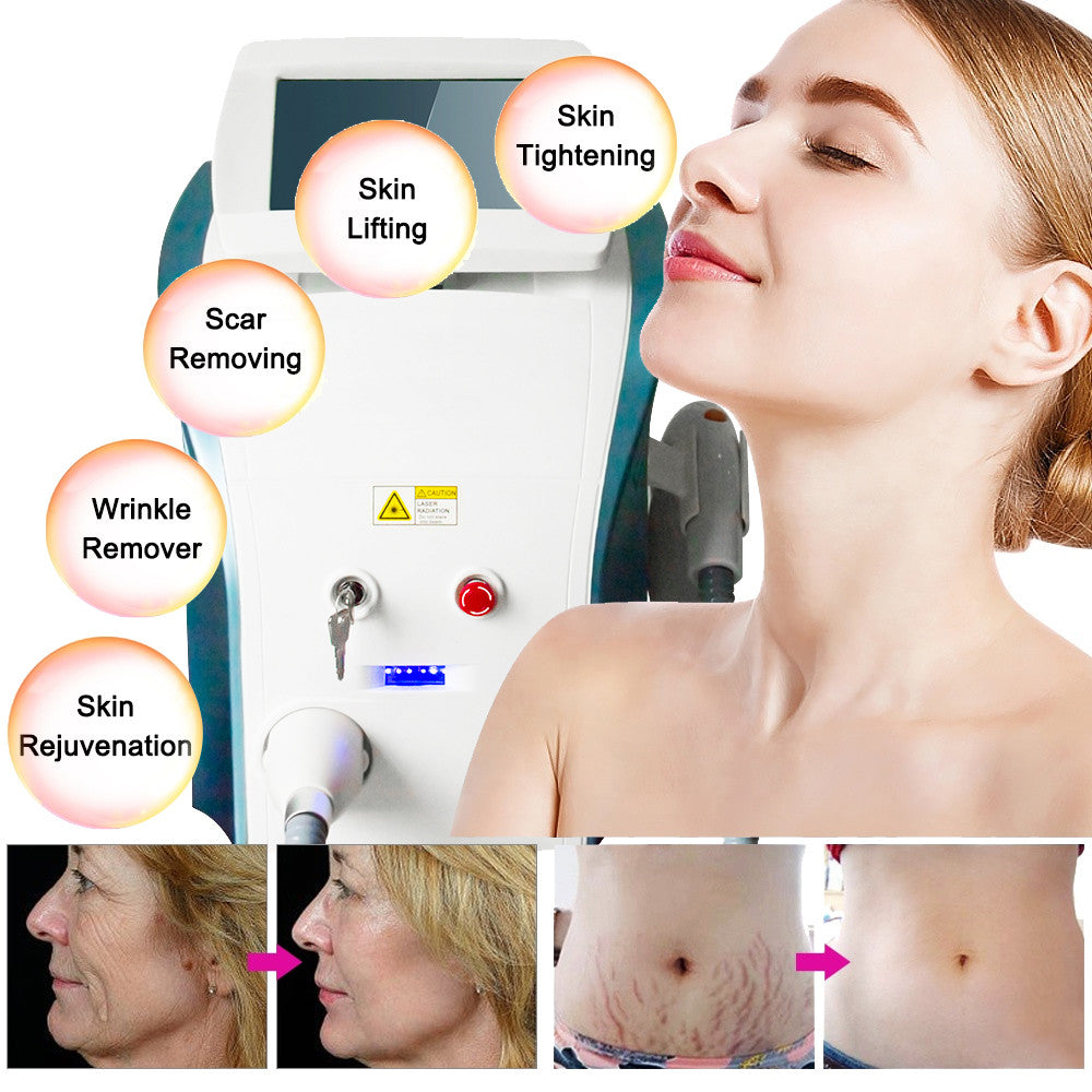 IPL OPT Machine, Aesthetic Laser Hair Remover, E-Light Skin Rejuvenation Machine, Vascular Multi-Application Hair Removal